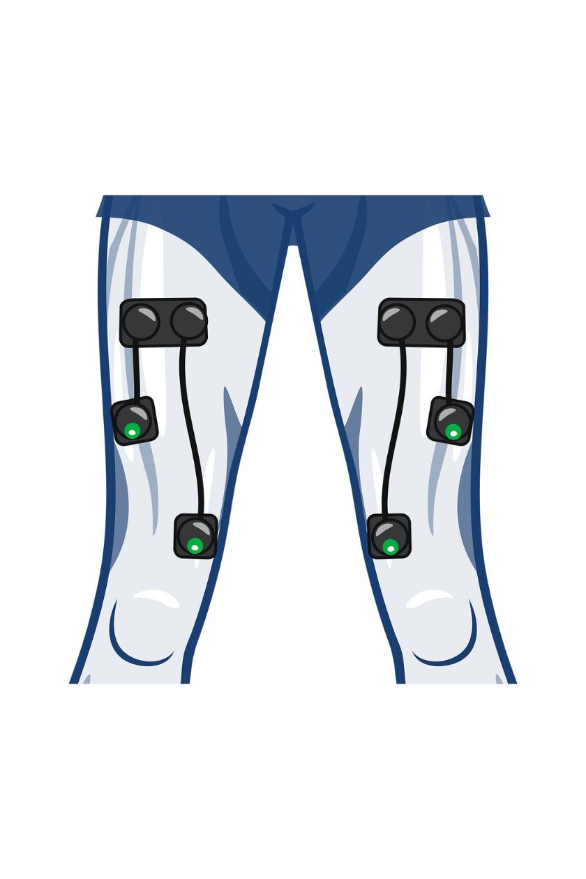 Quads (4 channels) electrode placement for women with wireless Compex EMS muscle stimulator
