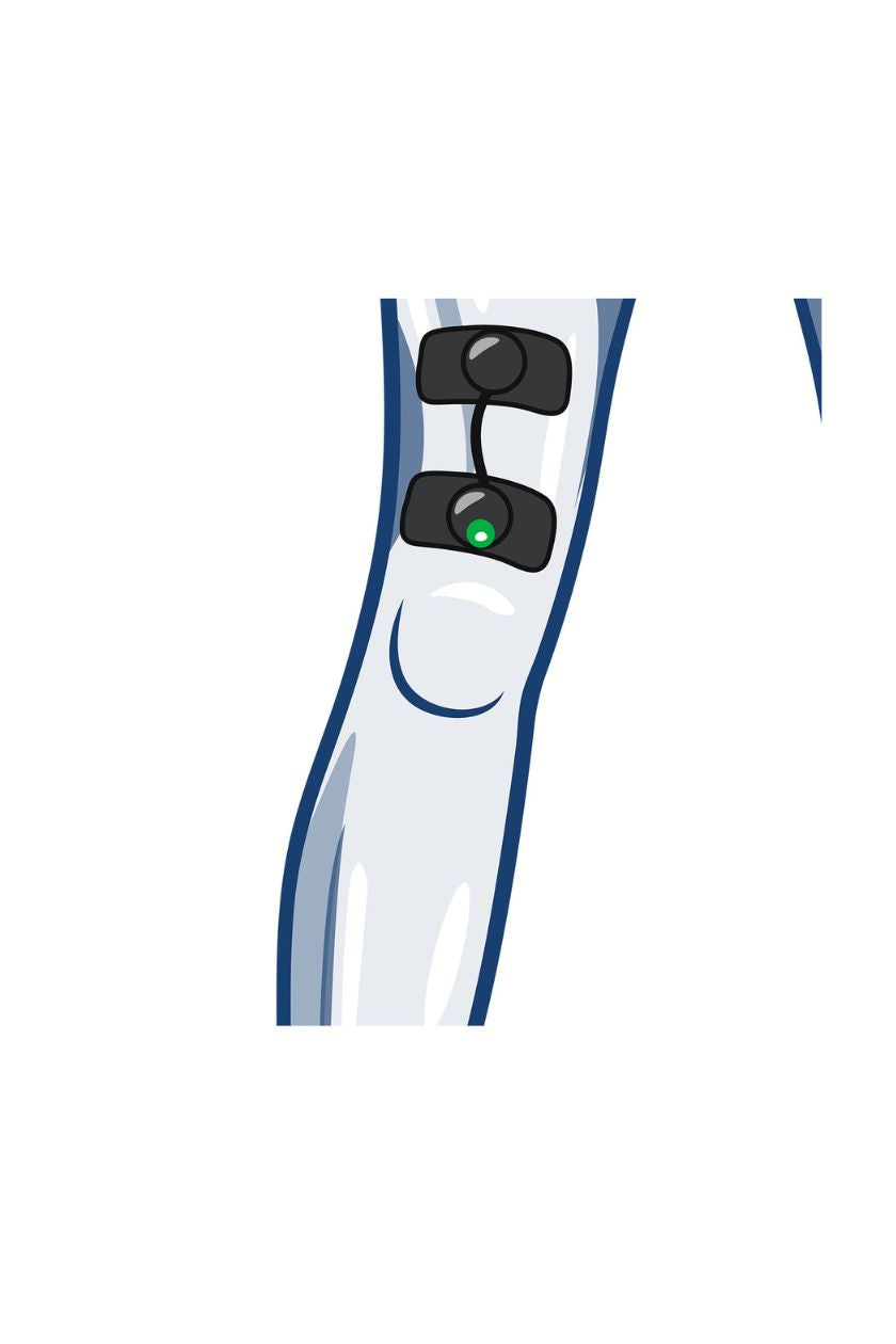 Quads (low) electrode placement for women with wireless Compex EMS muscle stimulator