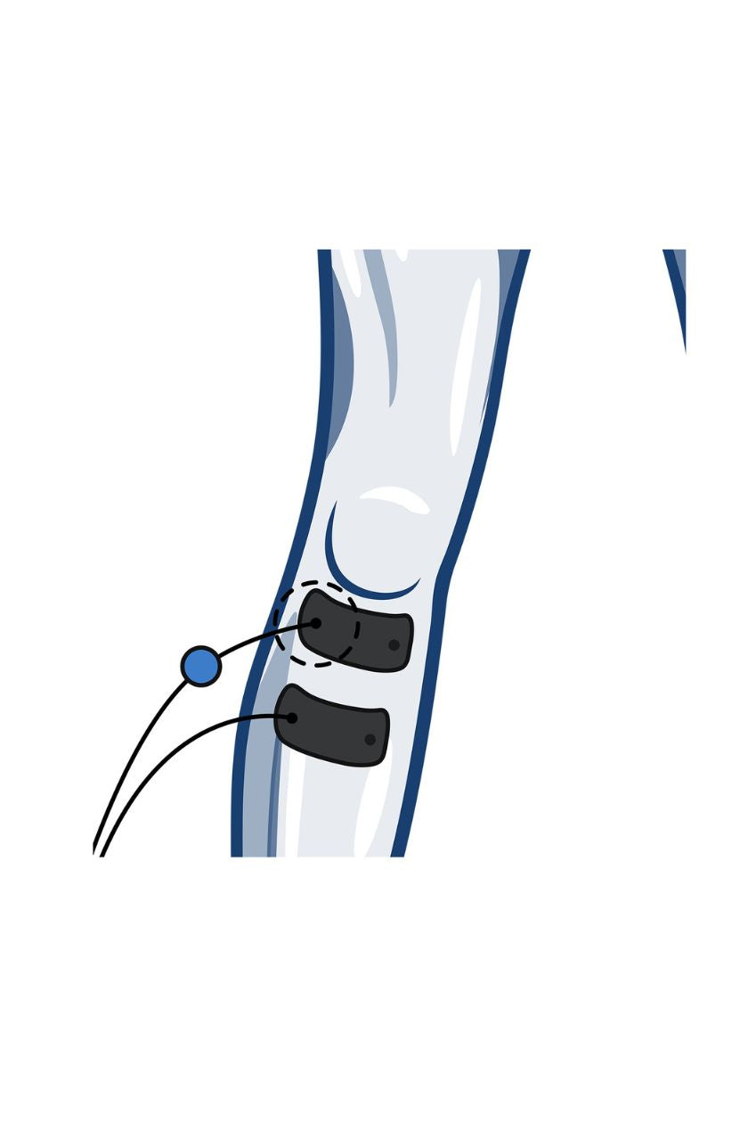 Shin electrode placement for women with wired Compex EMS muscle stimulator