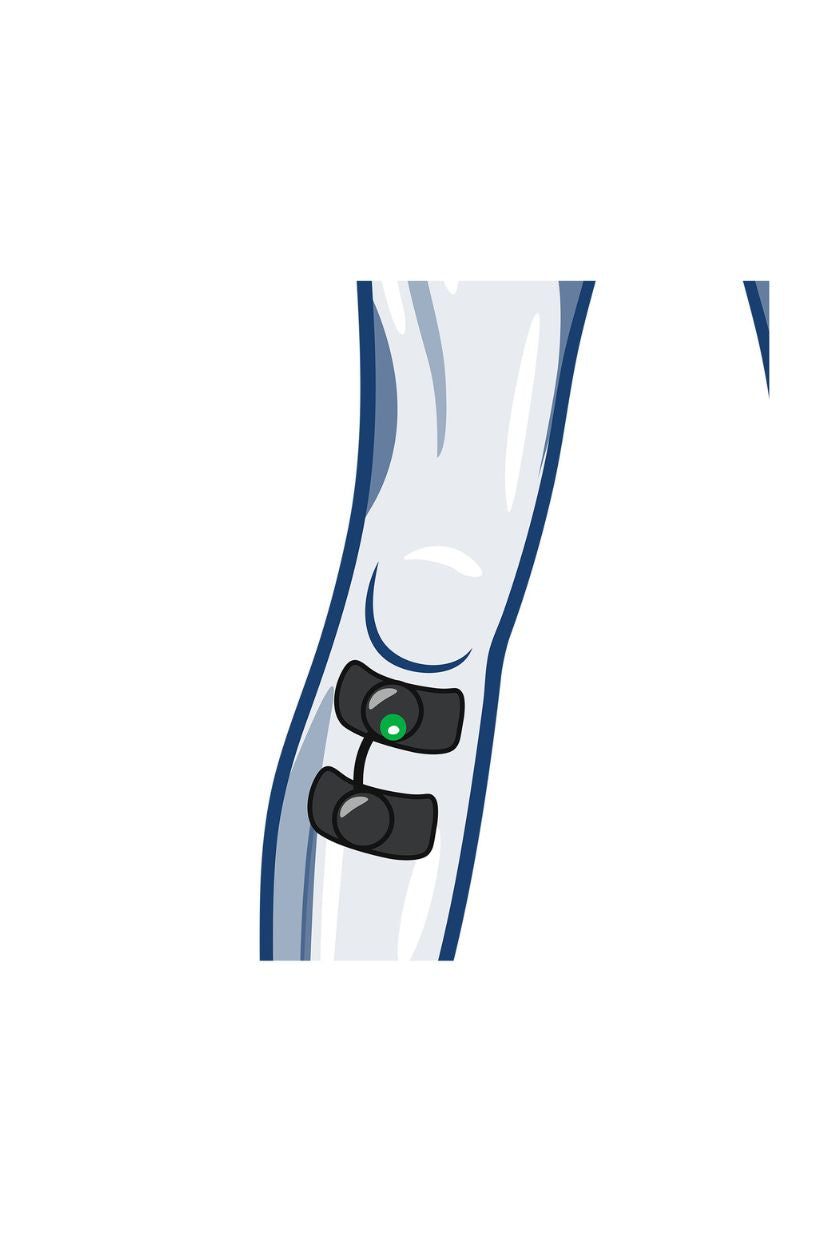 Shin electrode placement for women with wireless Compex EMS muscle stimulator