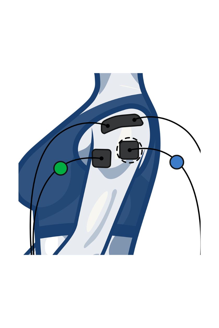 2 channel shoulder electrode placement for women with wired Compex EMS muscle stimulator