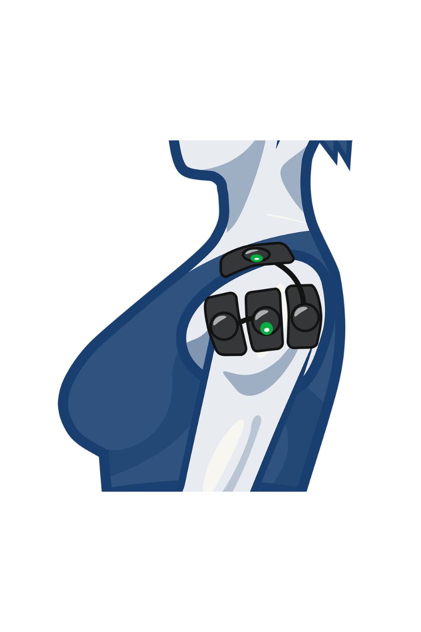 Shoulder (4 channels) electrode placement for women with wireless Compex EMS muscle stimulator