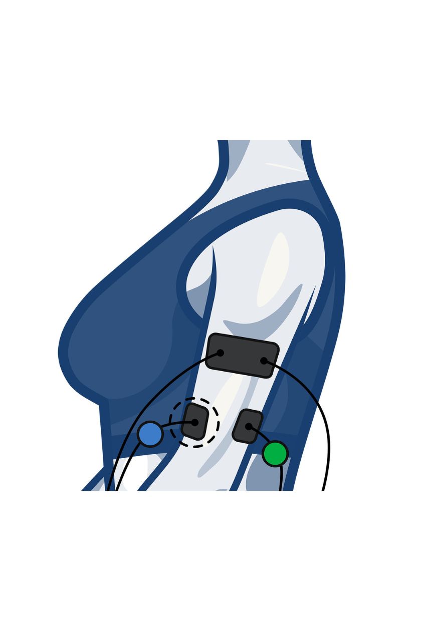 Upper arm electrode placement for women with wired Compex EMS muscle stimulator