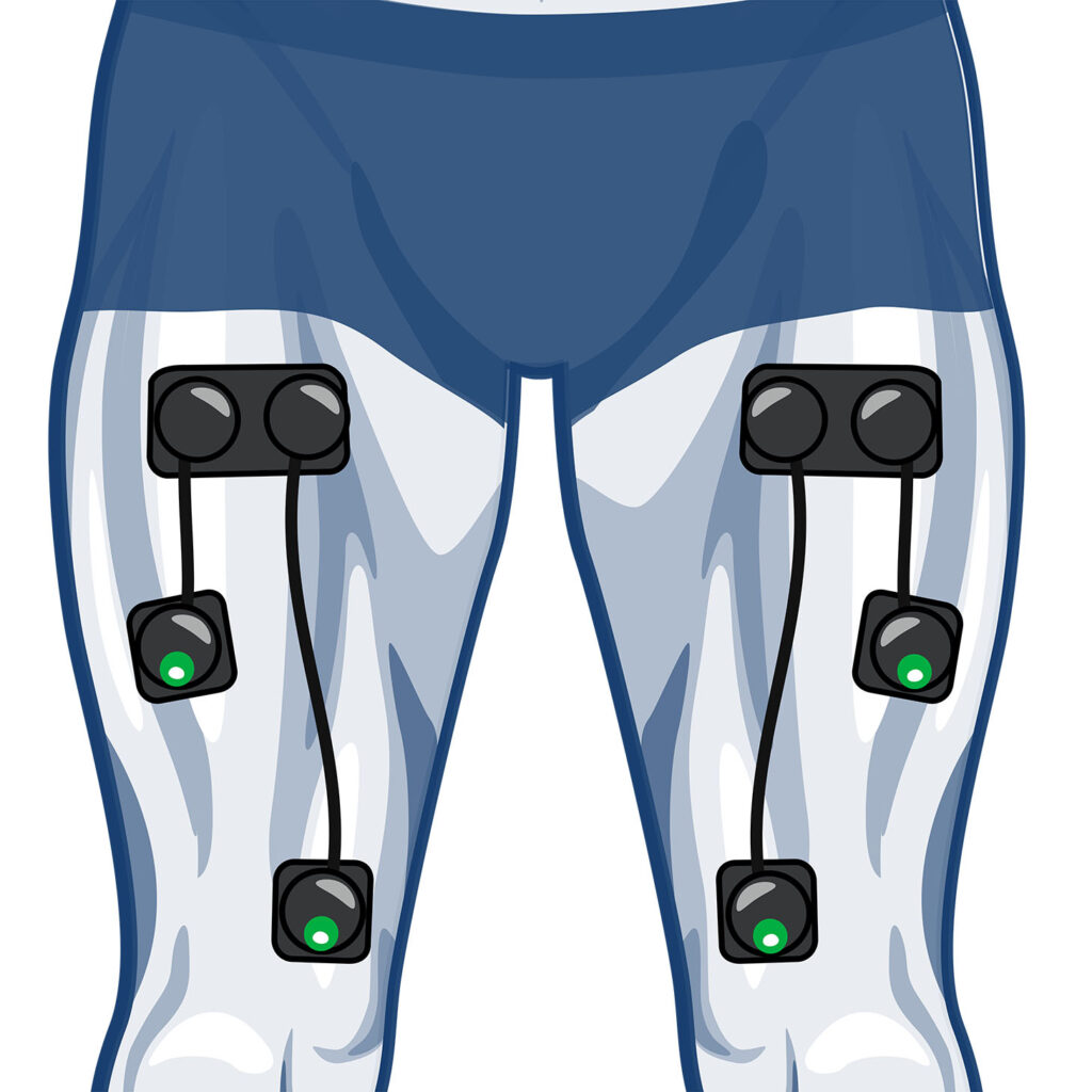 Wireless electrode placement for quads