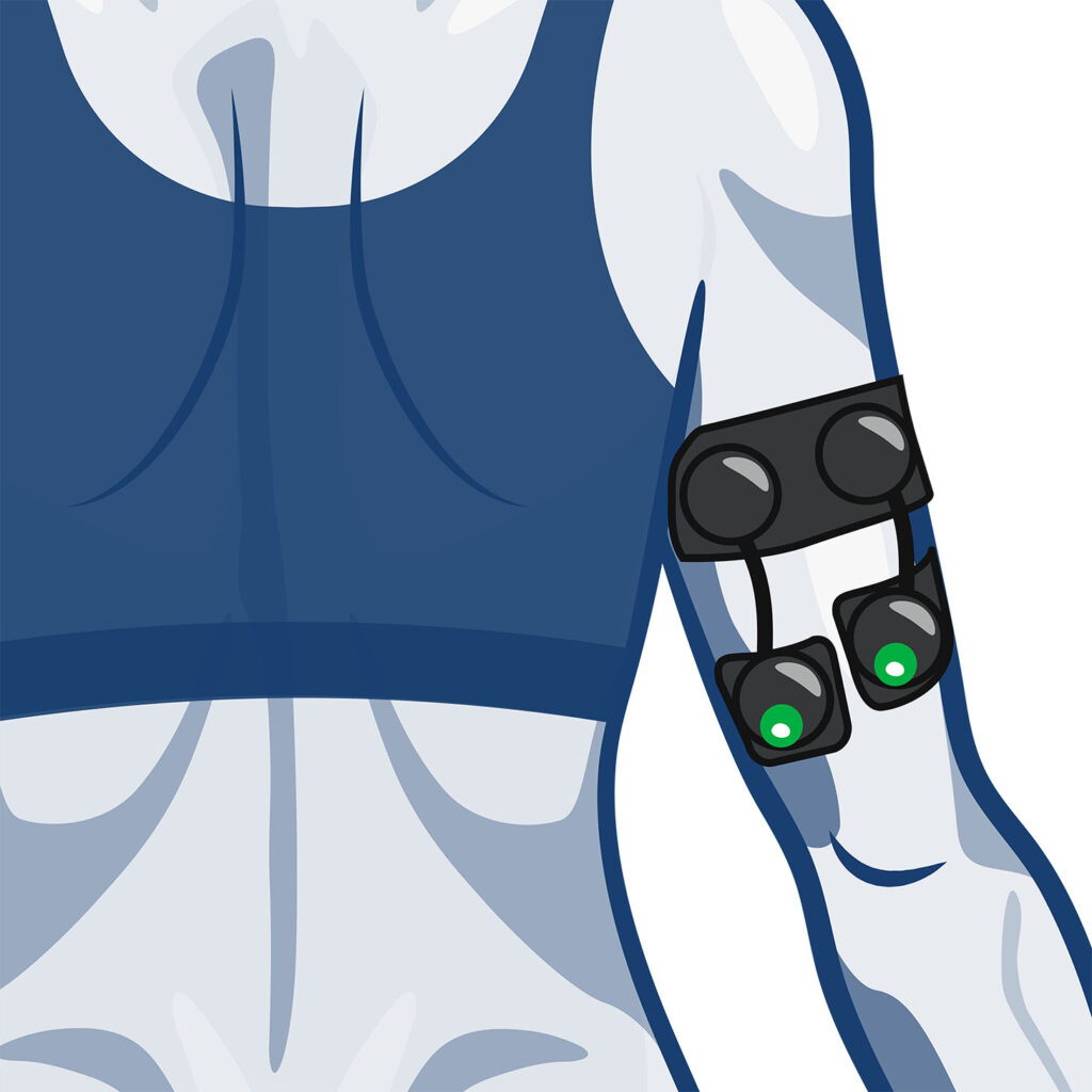 Compex recommended tricep electrode placement