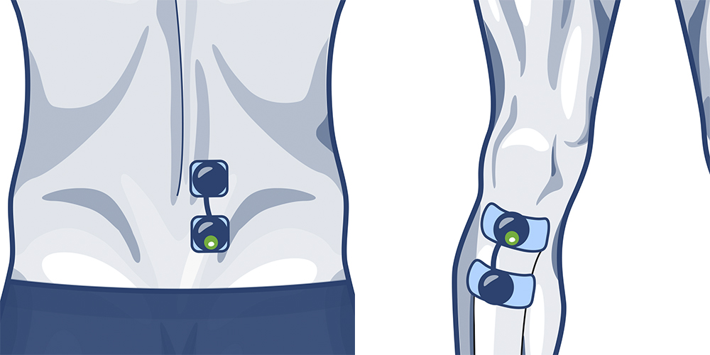 COMPEX : Quand utiliser l'électrostimulation et pourquoi l'utiliser ?