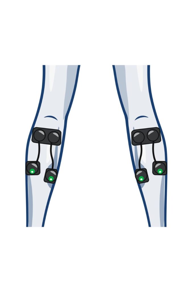4 channel calf electrode placement for women with wireless Compex EMS muscle stimulator