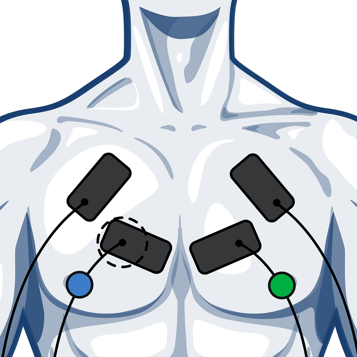 Parches de electrodos Tens para estimuladores Compex musculares