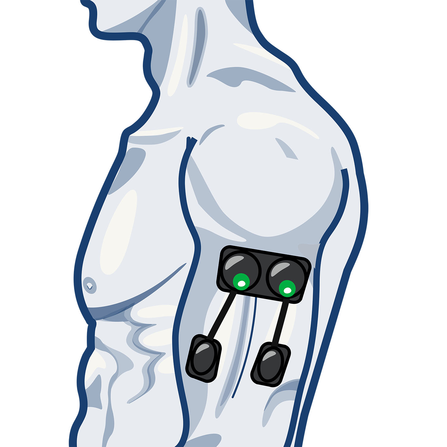 Abdominal Muscles Electrode Placement for Compex Muscle
