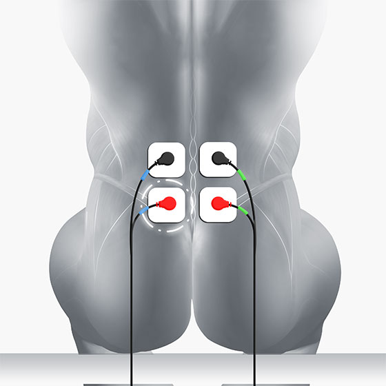 lower back electrode placement