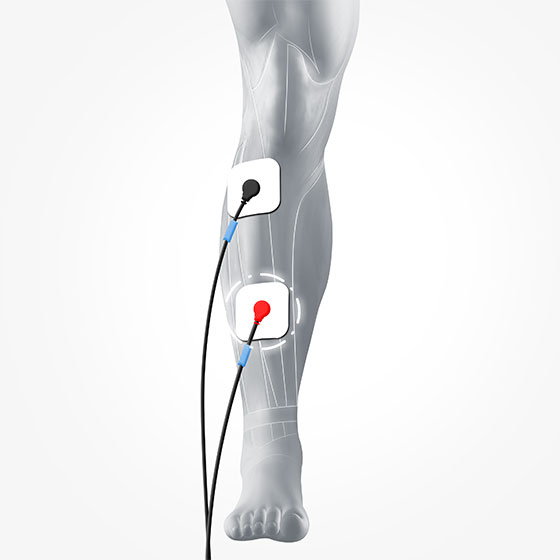 Foot Muscle Electrode Placement for Compex Muscle Stimulators