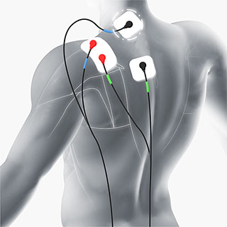 Electrode placement in TENS (a) and HF (b) treatment