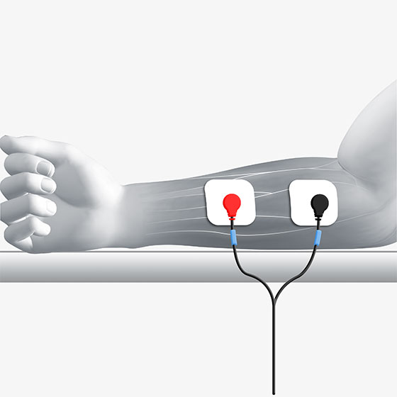 Position of the electrical muscle stimulation electrodes placed
