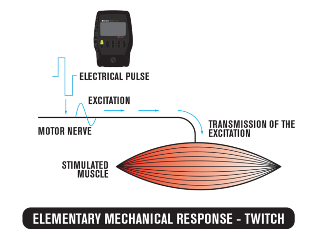 Motor Points For Electrical Stimulation Chart